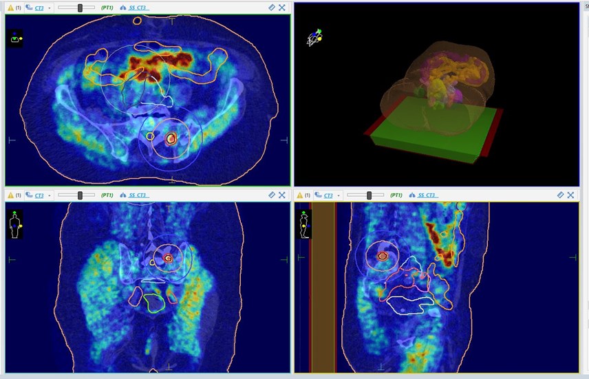 Foto: Ministrastvo zdravstva