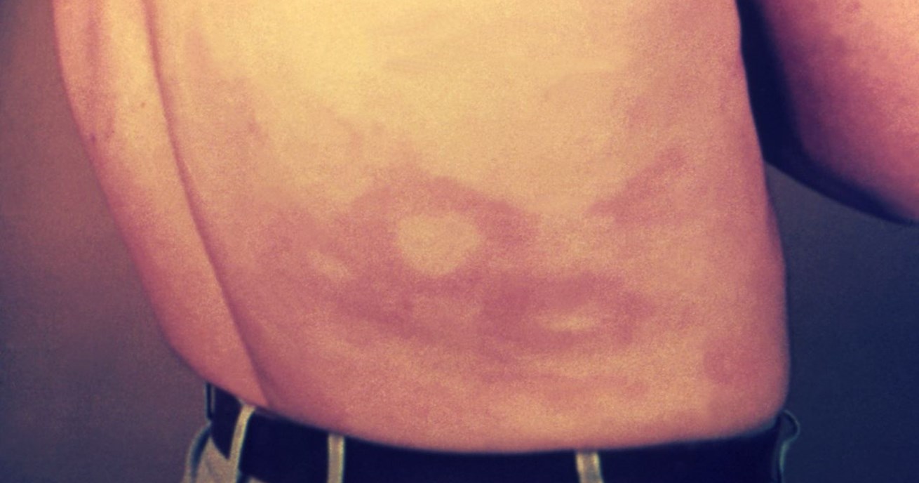 Foto: Public Domain, Centers for Disease Control (USA) 