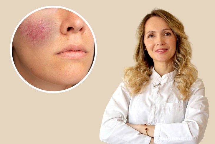 Foto: Privatna arhiva Diane Ćesić, Feepik