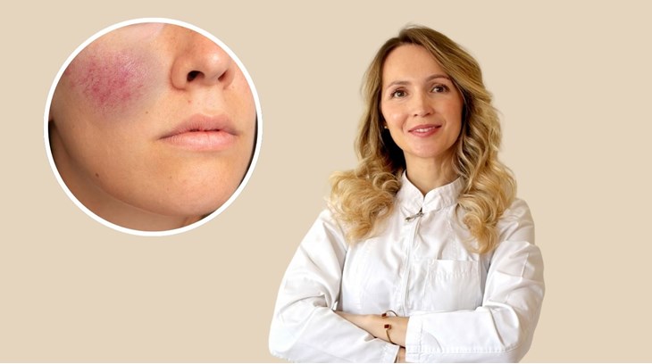 Foto: Privatna arhiva Diane Ćesić, Feepik